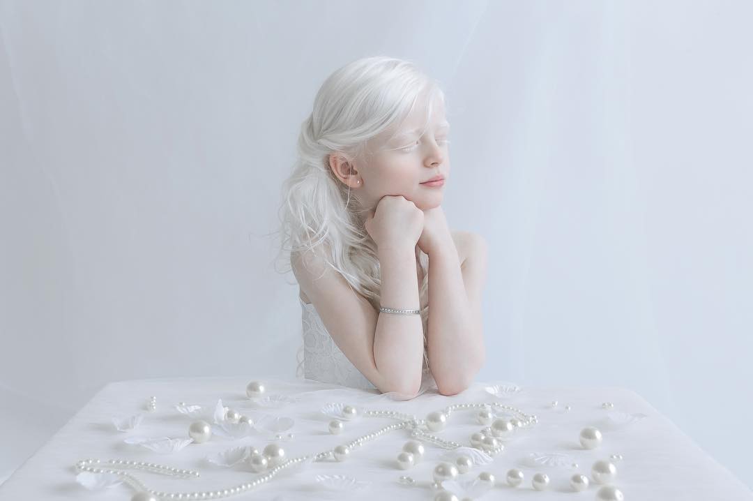 Porcelain Beauty The Hypnotizing Beauty Of Albino People Captured By Yulia Taits 12
