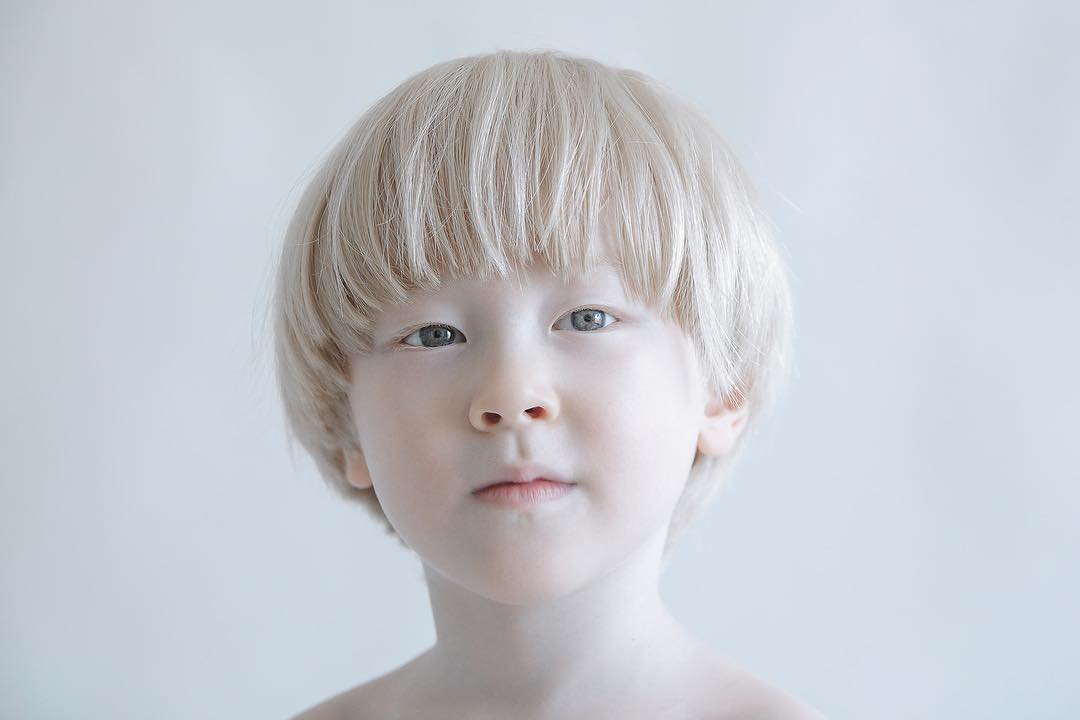 Porcelain Beauty The Hypnotizing Beauty Of Albino People Captured By Yulia Taits 19