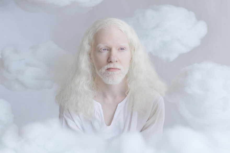 Porcelain Beauty The Hypnotizing Beauty Of Albino People Captured By Yulia Taits 3
