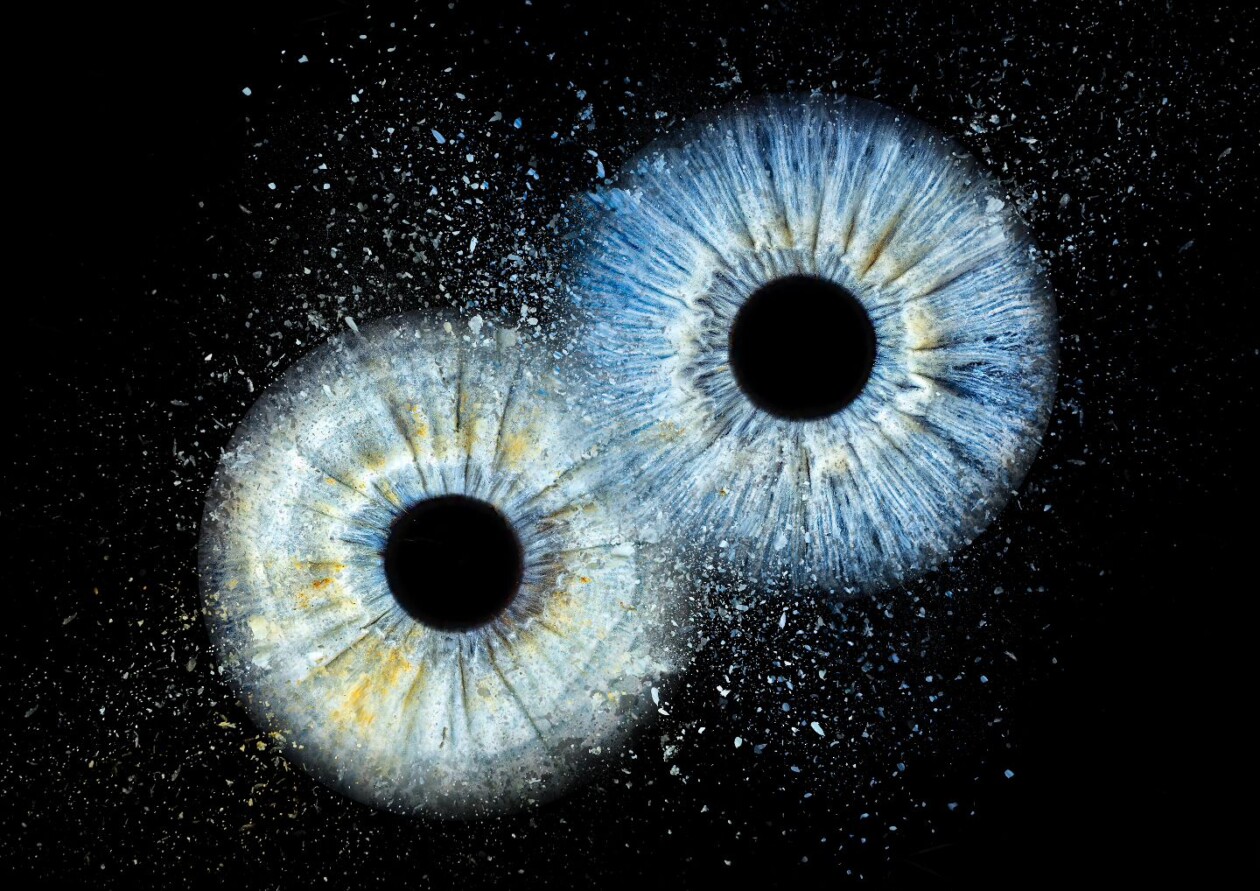 Unveiling The Uniqueness Within, Capturing The Soul Through Iris Art (6)