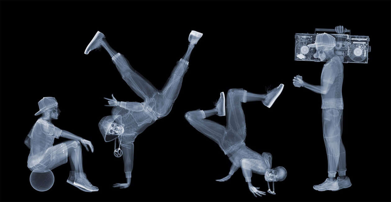 The Fascinating X Ray Photography Of Nick Veasey (12)