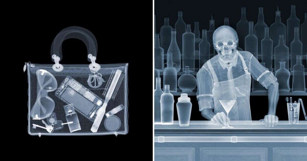 Revealing hidden details: the fascinating X-ray photography of